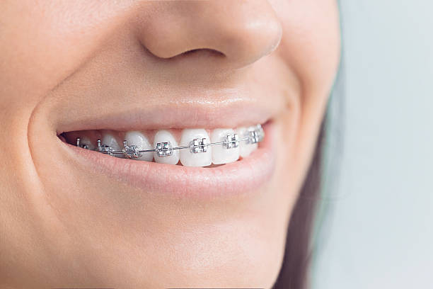 Best Traditional Braces  in Caledonia, MI